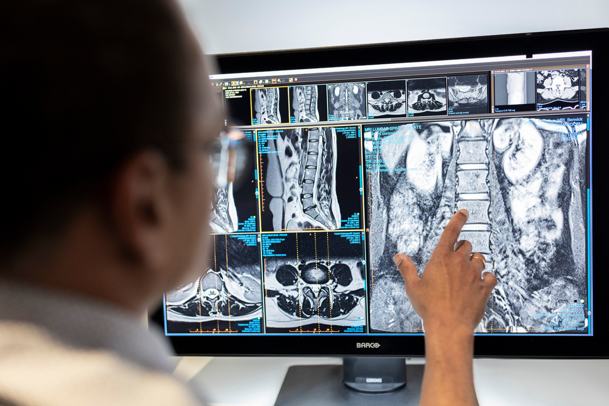 Male Doctor Examining Spinal Cord Xray Result | Ultrasound Services Near Me | Direct Radiology 