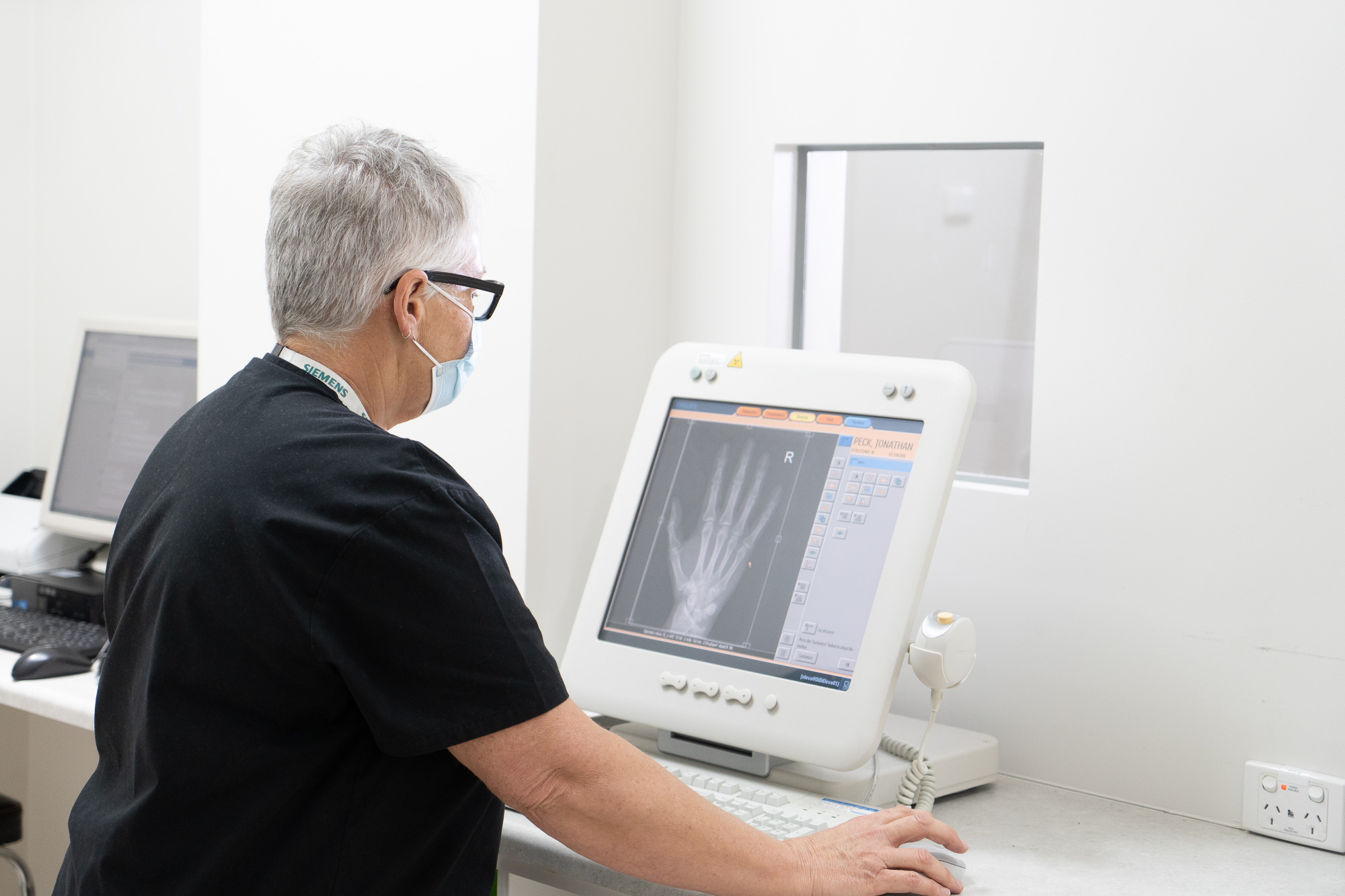 Doctor Studying Hand Xray Results Of A Patient | Bone Density Test Near Me | Direct Radiology